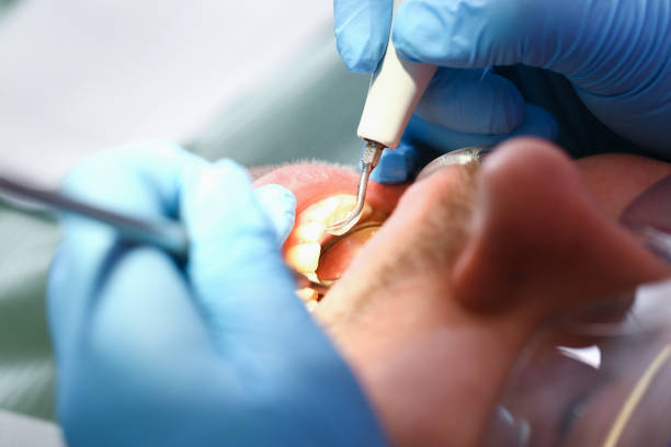 Best After-Hours Emergency Dentist in Kure Beach, NC