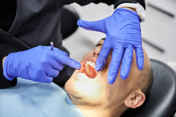 Best Emergency Tooth Extraction in Kure Beach, NC